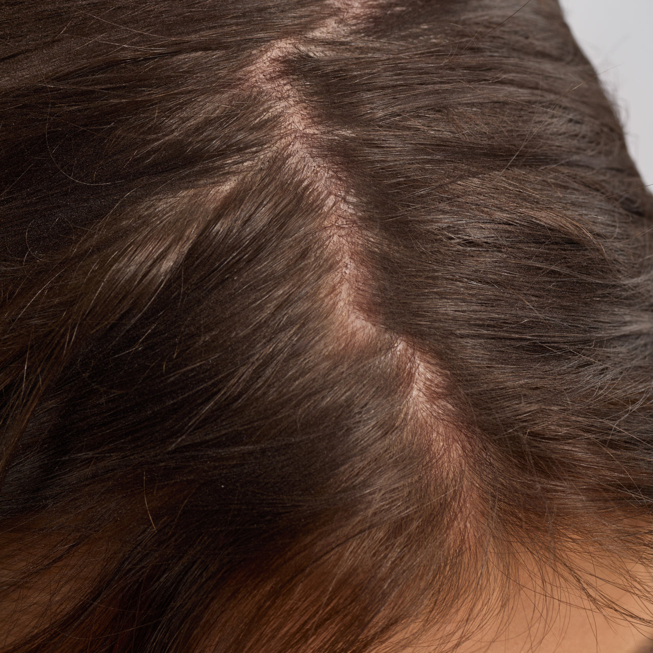 67830-60633-67823-Scalp_HairOilApplicator-Terracotta-Model-Consumables-2-Before-1280x1280px_ffe64ae5-6e12-453f-bbd3-9fb6c8400bcf-1.jpg